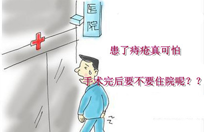 痔疮手术需要住院吗